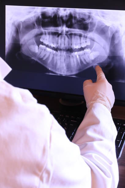 Best Emergency Wisdom Teeth Removal in Seat Pleasant, MD