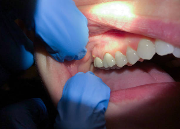 Best Pediatric Emergency Dentist in Seat Pleasant, MD