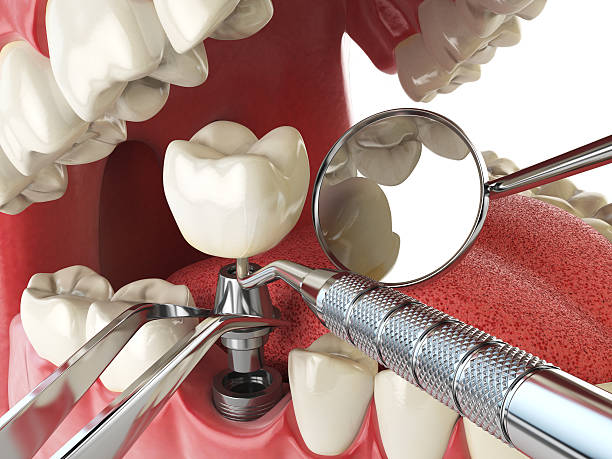 Best Weekend Emergency Dentist in Seat Pleasant, MD